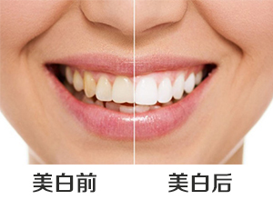 惠州美容冠