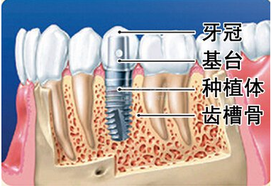 长期缺牙会危害健康吗