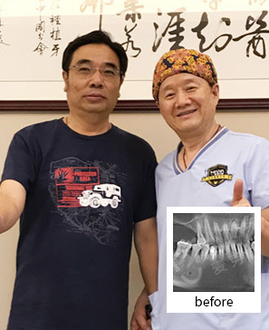 种牙让妈妈更美更健康