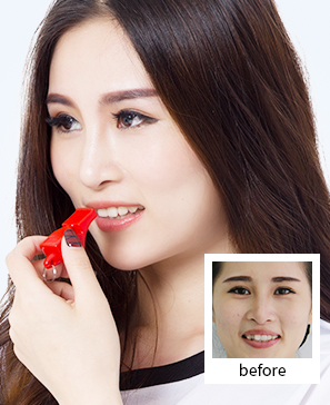 “改变牙齿，呆萌主播变傲娇女神