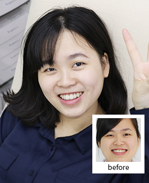 “年轻白领不漏痕迹，悄然变美