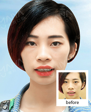 “幼儿园老师变形记
