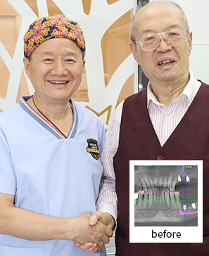 人民日报资深记者选择麦芽种牙